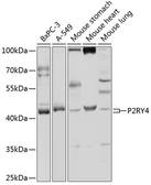 Anti-P2Y4 antibody used in Western Blot (WB). GTX54638