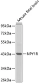 Anti-NPY1R antibody used in Western Blot (WB). GTX54639