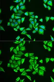 Anti-PGM1 antibody used in Immunocytochemistry/ Immunofluorescence (ICC/IF). GTX54640