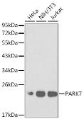 Anti-Park7 / DJ-1 antibody used in Western Blot (WB). GTX54642