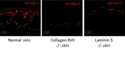 Anti-COL17A1 antibody [NC16a-3] used in IHC (Frozen sections) (IHC-Fr). GTX54647