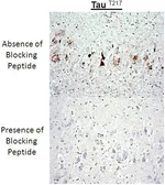 Anti-Tau (phospho Thr217) antibody used in Immunohistochemistry (IHC). GTX54655