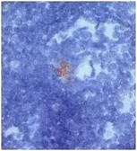 Anti-Dectin-2 antibody used in Immunohistochemistry (IHC). GTX54664