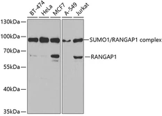 Anti-RanGAP1 antibody used in Western Blot (WB). GTX54667