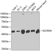 Anti-SCCPDH antibody used in Western Blot (WB). GTX54668