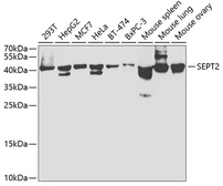 Anti-Septin 2 antibody used in Western Blot (WB). GTX54669
