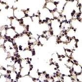 Anti-Splicing Factor 1 antibody used in IHC (Paraffin sections) (IHC-P). GTX54670