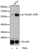 Anti-Smad1 (phospho Ser206) antibody used in Western Blot (WB). GTX54671