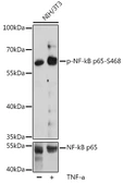 Anti-NFkB p65 (phospho Ser468) antibody used in Western Blot (WB). GTX54673