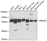 Anti-PTPIP51 antibody used in Western Blot (WB). GTX54674