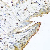 Anti-RNase 13 antibody used in IHC (Paraffin sections) (IHC-P). GTX54675
