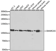 Anti-SNF2H antibody used in Western Blot (WB). GTX54677
