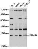 Anti-Rab11A antibody used in Western Blot (WB). GTX54678