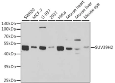 Anti-SUV39H2 antibody used in Western Blot (WB). GTX54682