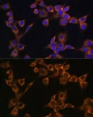 Anti-RAMP1 antibody used in Immunocytochemistry/ Immunofluorescence (ICC/IF). GTX54684