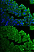 Anti-RPLP0 antibody used in Immunocytochemistry/ Immunofluorescence (ICC/IF). GTX54687