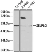 Anti-CD162 antibody used in Western Blot (WB). GTX54688