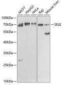 Anti-CD62E antibody used in Western Blot (WB). GTX54691