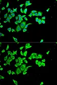 Anti-M/NEI antibody used in Immunocytochemistry/ Immunofluorescence (ICC/IF). GTX54692