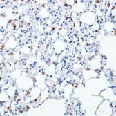 Anti-SFTPC antibody used in IHC (Paraffin sections) (IHC-P). GTX54694