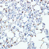 Anti-SFTPC antibody used in IHC (Paraffin sections) (IHC-P). GTX54694