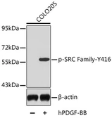 Anti-Src (phospho Tyr416) antibody used in Western Blot (WB). GTX54701