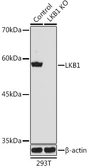 Anti-LKB1 antibody used in Western Blot (WB). GTX54702