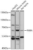 Anti-Retinoic Acid Receptor alpha antibody used in Western Blot (WB). GTX54703