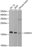 Anti-SUMO2 antibody used in Western Blot (WB). GTX54705