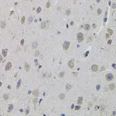 Anti-SUMO3 antibody used in IHC (Paraffin sections) (IHC-P). GTX54706