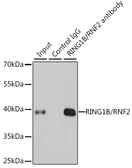 Anti-RNF2 antibody used in Immunoprecipitation (IP). GTX54707