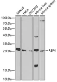 Anti-RBP4 antibody used in Western Blot (WB). GTX54709