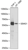 Anti-Semenogelin I antibody used in Western Blot (WB). GTX54712