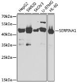 Anti-alpha 1 Antitrypsin antibody used in Western Blot (WB). GTX54713