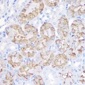 Anti-alpha 1 Antitrypsin antibody used in IHC (Paraffin sections) (IHC-P). GTX54713