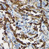 Anti-Surfactant Protein A antibody used in IHC (Paraffin sections) (IHC-P). GTX54714