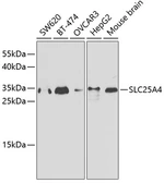 Anti-Adenine Nucleotide Translocase 1 antibody used in Western Blot (WB). GTX54715