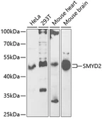 Anti-SMYD2 antibody used in Western Blot (WB). GTX54717