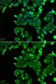 Anti-Stomatin antibody used in Immunocytochemistry/ Immunofluorescence (ICC/IF). GTX54719