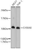 Anti-S100A8 antibody used in Western Blot (WB). GTX54721