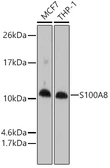 Anti-S100A8 antibody used in Western Blot (WB). GTX54721