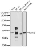 Anti-Rad52 antibody used in Western Blot (WB). GTX54722