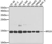 Anti-RPS19 antibody used in Western Blot (WB). GTX54725