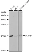 Anti-SH2D1A antibody used in Western Blot (WB). GTX54727