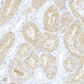 Anti-Sorbitol Dehydrogenase antibody used in IHC (Paraffin sections) (IHC-P). GTX54728
