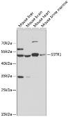 Anti-Somatostatin receptor 1 antibody used in Western Blot (WB). GTX54732