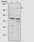 Anti-CDH11 antibody [5B2H5] used in Western Blot (WB). GTX54742