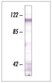 Anti-CDH11 antibody [5B2H5] used in Western Blot (WB). GTX54742
