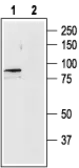 Anti-TRPV4 antibody used in Western Blot (WB). GTX54764