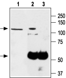 Anti-TRPA1 antibody used in Immunoprecipitation (IP). GTX54765